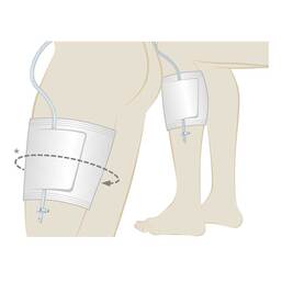 Abbildung: Uromed Beinbeutelhalter 489702 1 St PZN 09704116