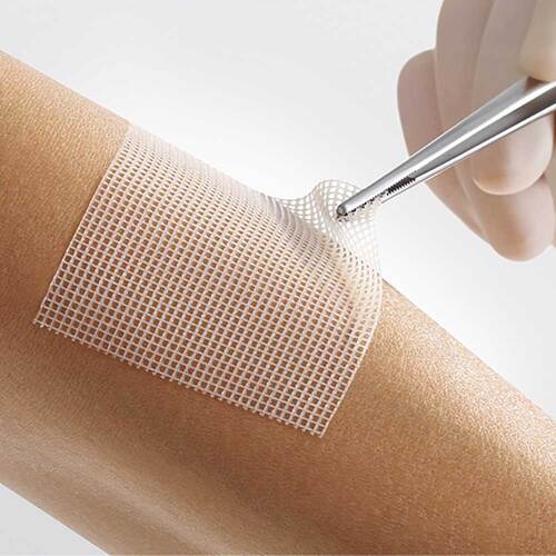 Lomatuell Pro 5x5 cm steril - 2