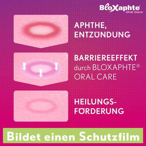 BloXaphte® Oral Care Mundspray bei Aphthen und Verletzungen im Mund - 4