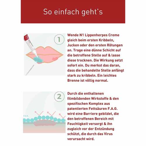 N1 Lippenherpes Creme, Packungsgr&ouml;&szlig;e 4 g - 3