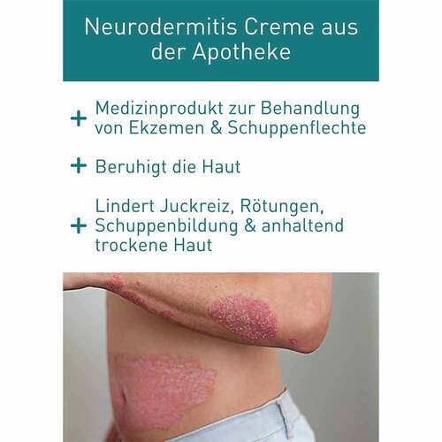 N1 Psoriasis Intensivcreme - 2