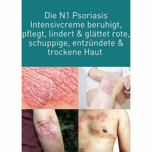 N1 Psoriasis Intensivcreme - 4