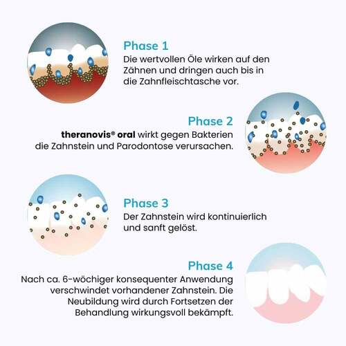 Theranovis oral Zahnstein Gel - 3