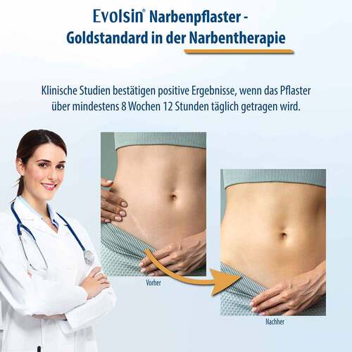 Evolsin Narbenpflaster 2x200 cm - 4