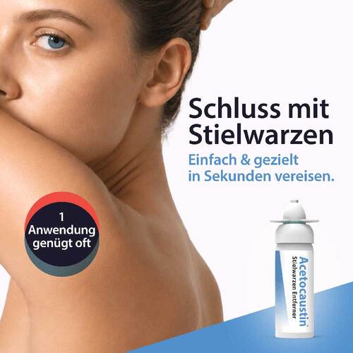 Acetocaustin Stielwarzen Entferner Stift - 2
