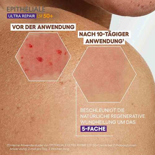 A-Derma Epitheliale Ultra Repair Creme LSF 50 + - 5