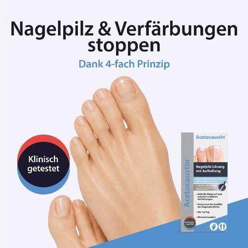 Acetocaustin Nagelpilz Lösung mit Aufhellung - 2