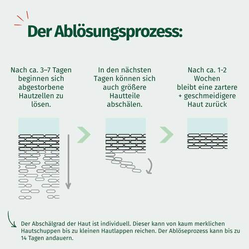 Allgäuer Latschenkiefer Hornhaut Entferner Maske Cremig - 6