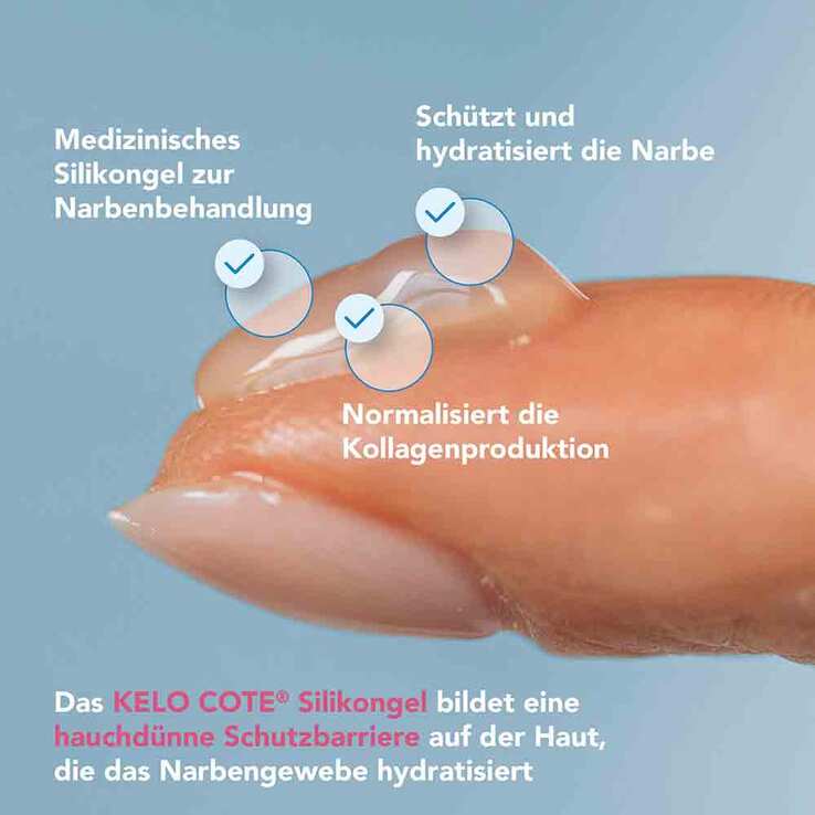 KELO-COTE® Narbengel - 3