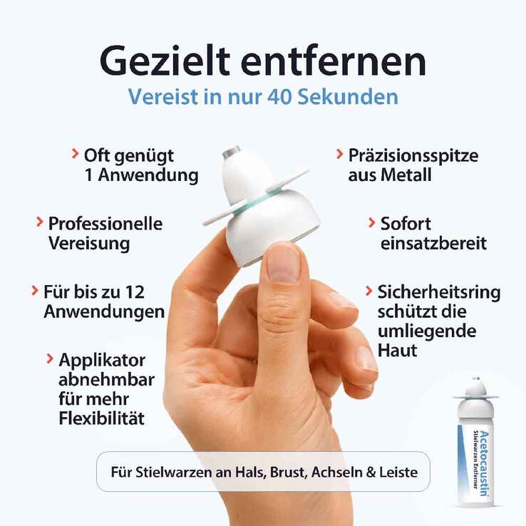 Acetocaustin Stielwarzen Entferner Stift - 3