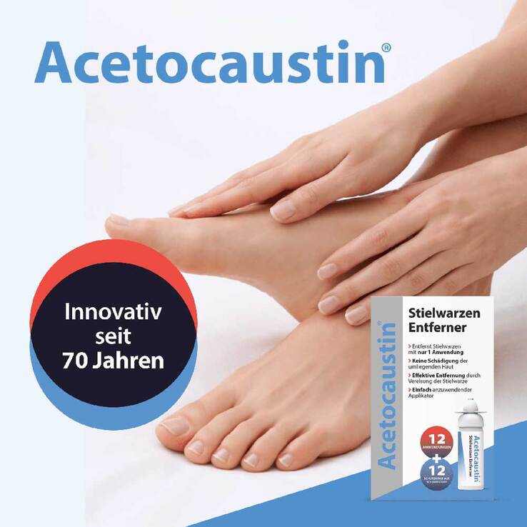 Acetocaustin Stielwarzen Entferner Stift - 6