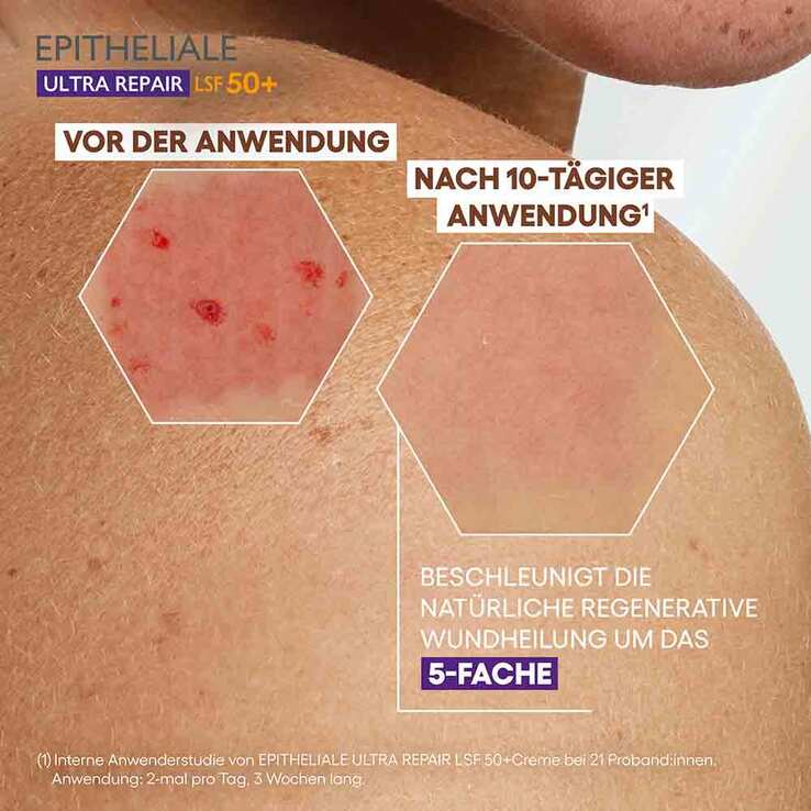 A-Derma Epitheliale Ultra Repair Creme LSF 50 + - 5