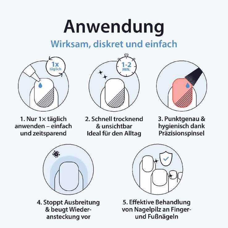 Acetocaustin Nagelpilz Lösung mit Aufhellung - 5