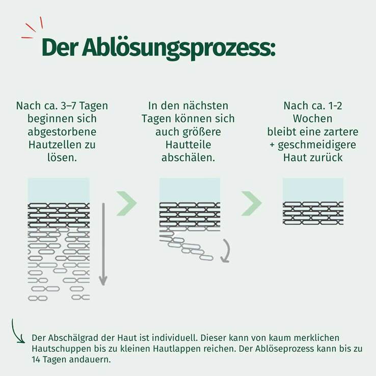 Allgäuer Latschenkiefer Hornhaut Entferner Maske Cremig - 6